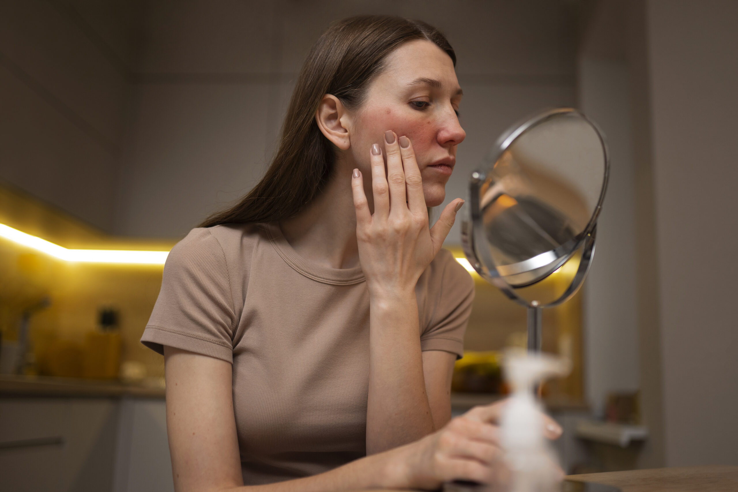 Rosacea: 6 triggers och vad som faktiskt lugnar rodnad