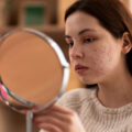 Young woman with facial acne examining her reflection in a round handheld mirror in a cozy room.
